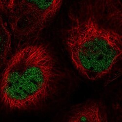 PNUTS/PPP1R10 Antibody, Novus Biologicals:Antibodies:Primary Antibodies